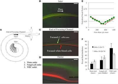 Rapid Isolation and Concentration of Pathogenic Fungi Using Inertial Focusing on a Chip-Based Platform